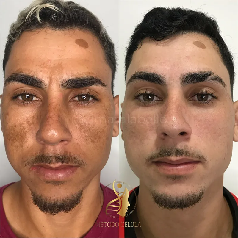 dr11_resultado