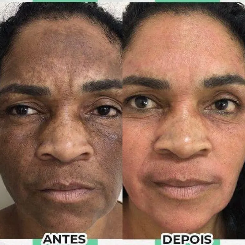 dr16_resultado