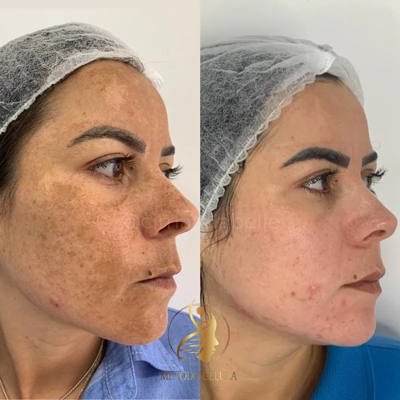 dr4_resultado