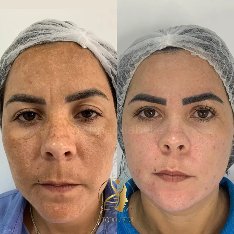 dr5_resultado