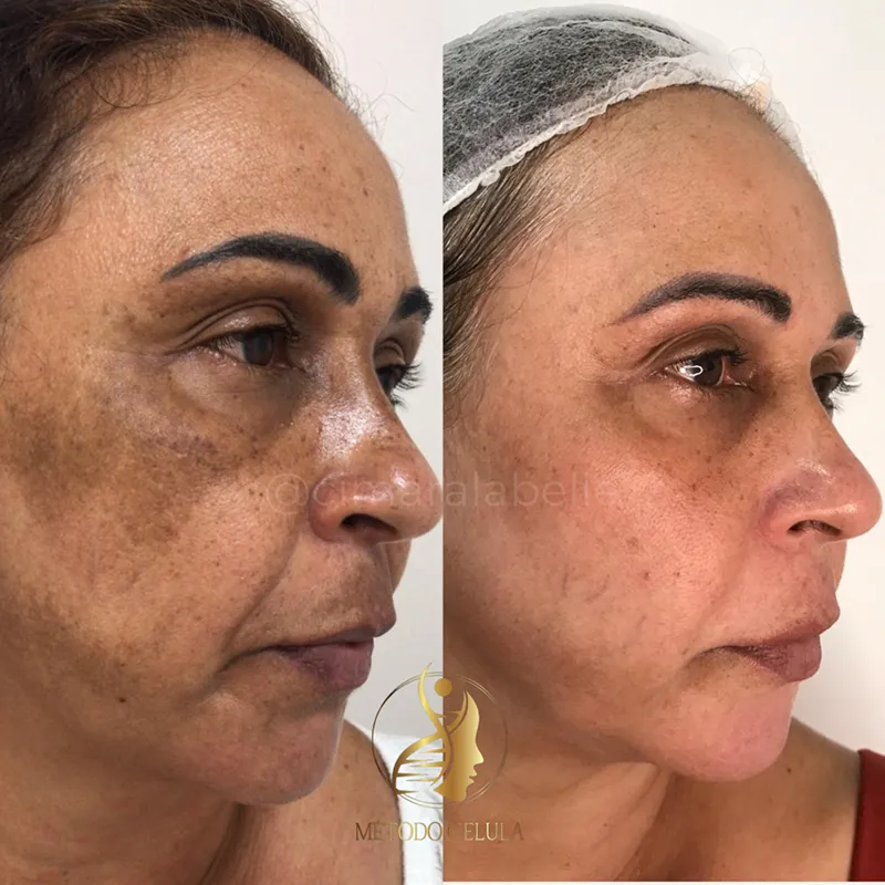 dr8_resultado